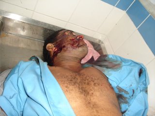 20070519200300-muerto.jpg